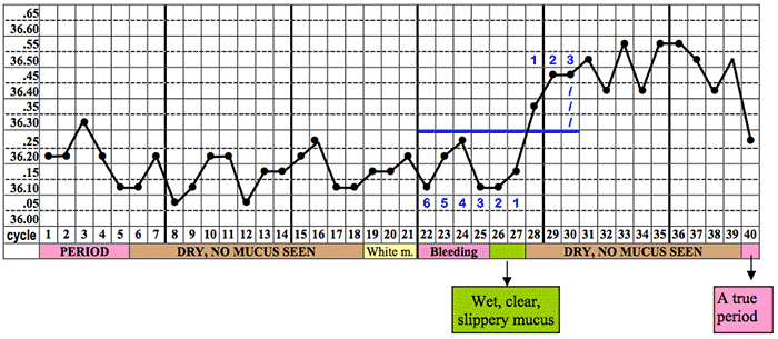 Anovulatory Cycle Chart