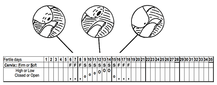 Chart noting cervix characteristics around the fertile days of the cycle.