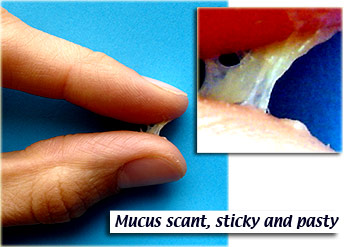 Stage 1 Mucus.